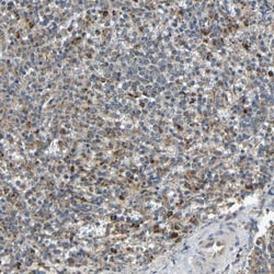 IGFBP-rP10/KAZALD1 Antibody, Novus Biologicals 0.1mL; Unlabeled:Antibodies,